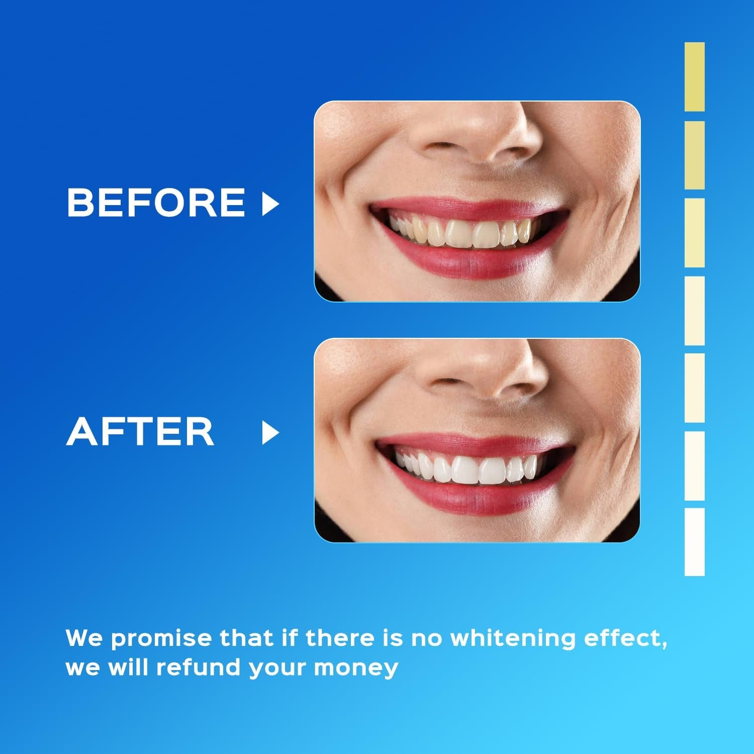 Teeth Whitening Kit 16X LED Light Rechargeable,Teeth Whitener Gel Pen Strips, with 30Ml Carbamide Peroxide Tooth Whitening Gel,3Ml Remineralization Gel,Built-In 15 Minute Timer，For Sensitive Teeth